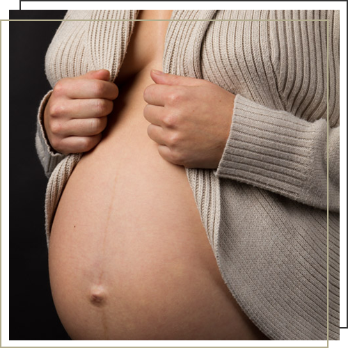 Maternity Right2